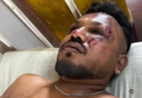 Passageiro sobrevive à queda de avião na Índia